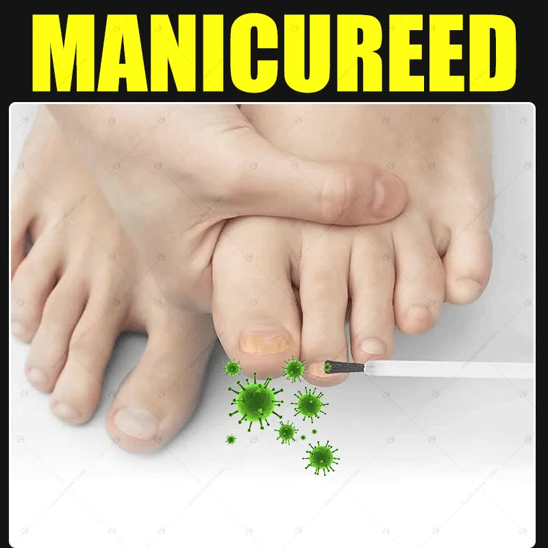 

2025 Toenail Fungus Patch Waterproof Nail Repair Patches Nail Ingrown Correction Sticker Discolored Damaged Nail Foot Care Tool