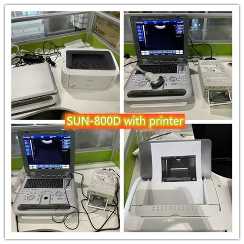 Hot Selling Laptop Digital Medical USG Machine 2D 3D Ultrasound Scanner SUN-800D4