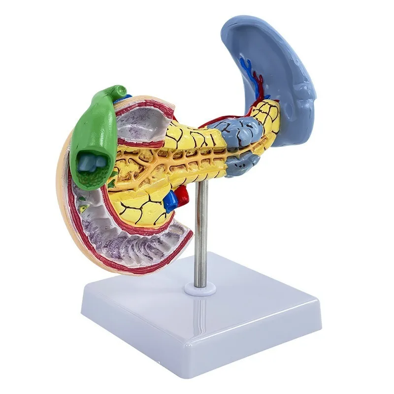 

Human Anatomical Lesions Pancreatic Spleen and Duodenum Medical Model Digestive