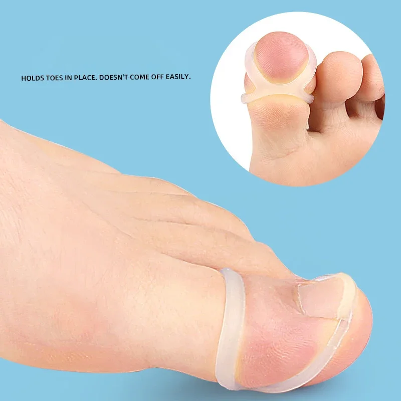 Outil de Correction des ongles incarnés en Silicone, Invisible, redressage des ongles incarnés, attelle de protection, pédicure, outils de soins des pieds