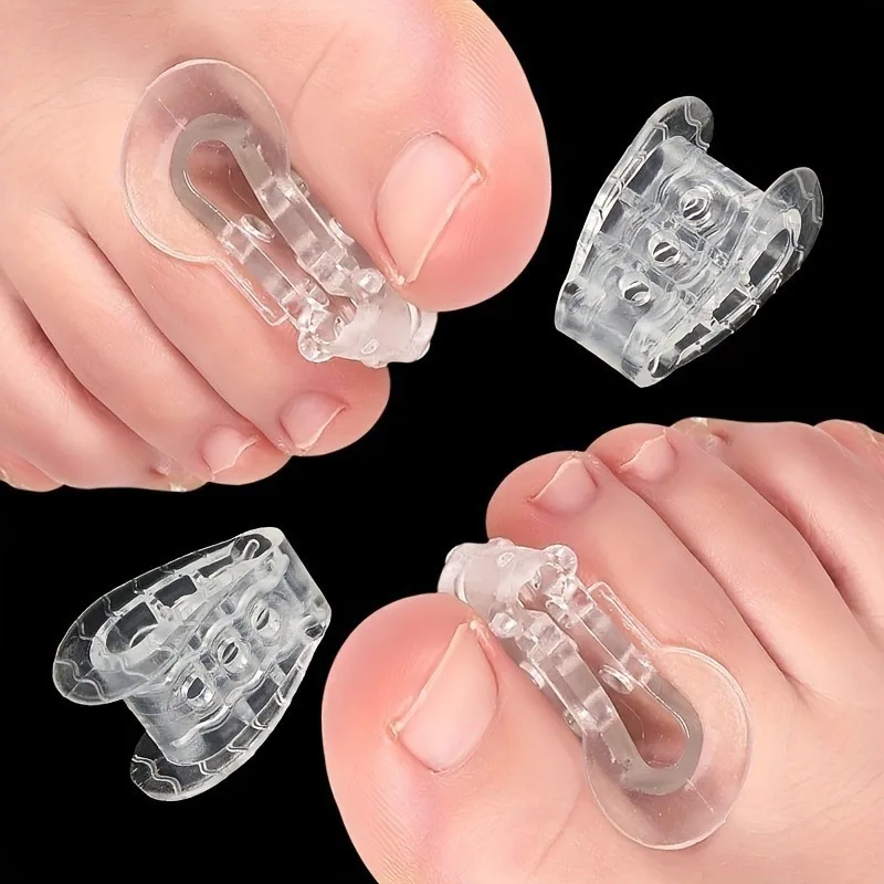 2pcs/4pcs Toe Splitter, Thumb Valgus Orthosis, Overlap Separator - Hand Washable, Non-Traditional Closure Type