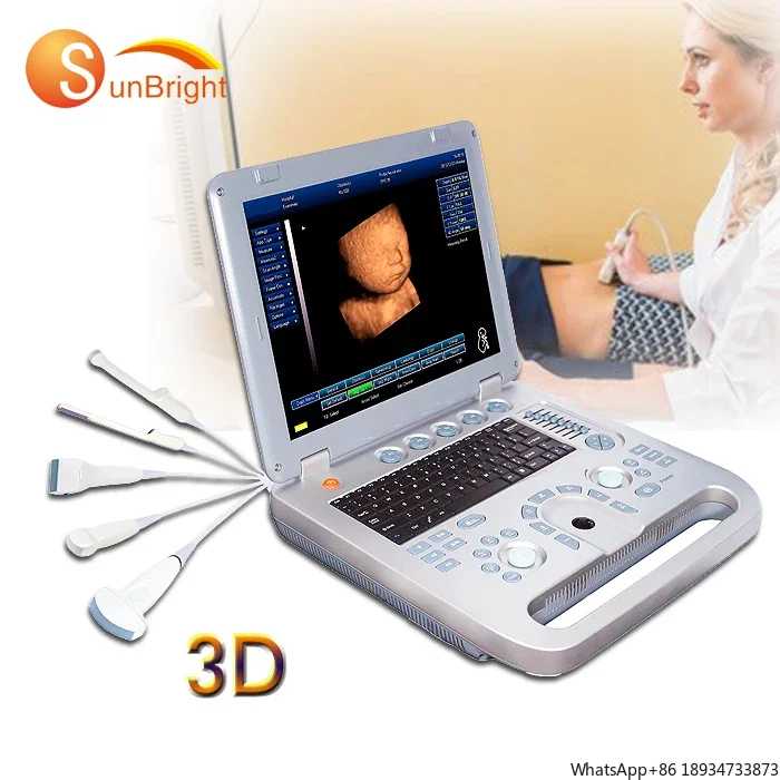 

Sun-800D Недорогой ультразвуковой аппарат для ноутбука больницы 3D OB GYN высокого качества