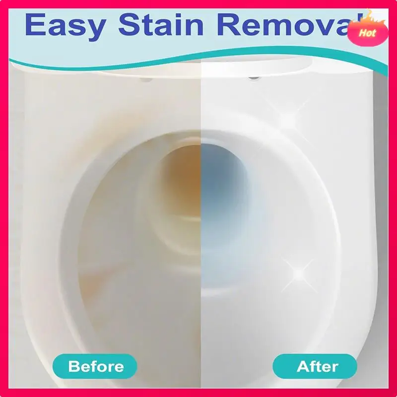 

Набор для чистки унитаза ABYP — 4 пемзы и 1 удлиненная ручка для чистки