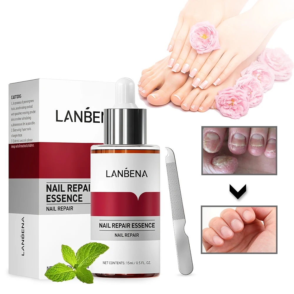 

15ml Nail Repair Essence Serum Anti Infection Paronychia Onychomycosis Treatment Foot Care Nail Fungus Removal Gel