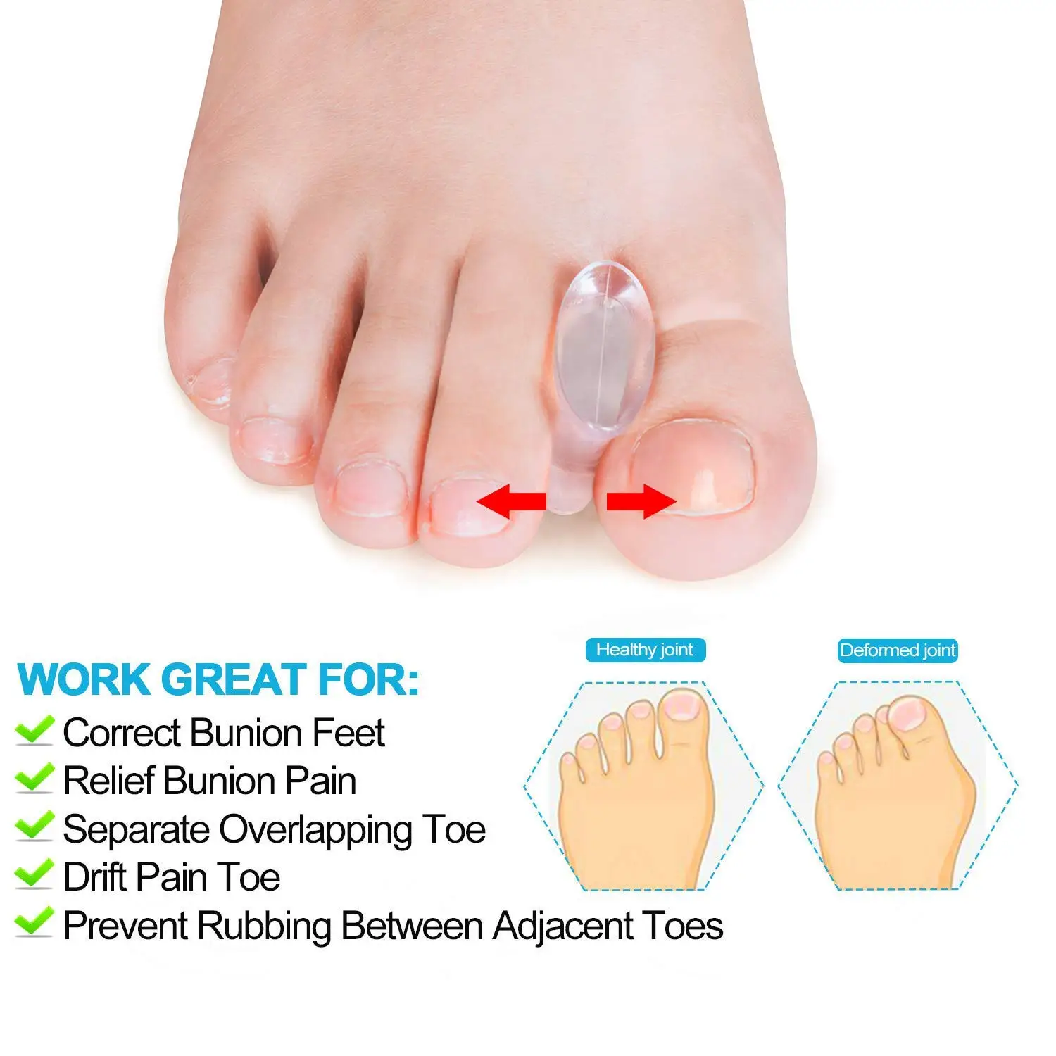 Gel Bunion Corrector and Toe Spacers Separators and Straightener Orthotics for Men and Women Overlapping Toes,Bunion Pain Relief