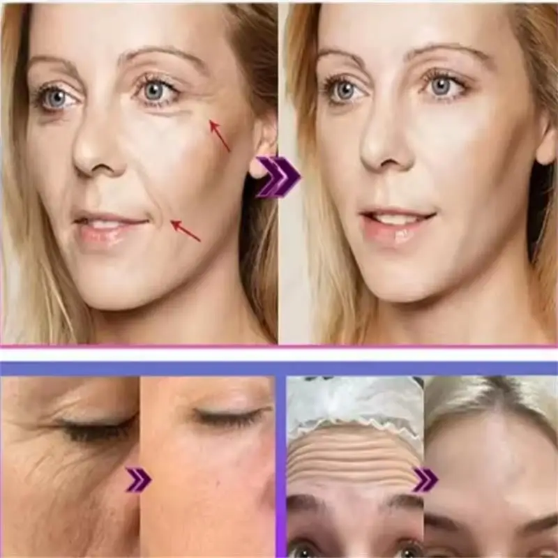 مزيل التجاعيد الفوري كريم وجه مكافحة الشيخوخة ثبات رفع تتلاشى الخطوط الدقيقة تبييض ترطيب سطع تشديد العناية بالبشرة #2