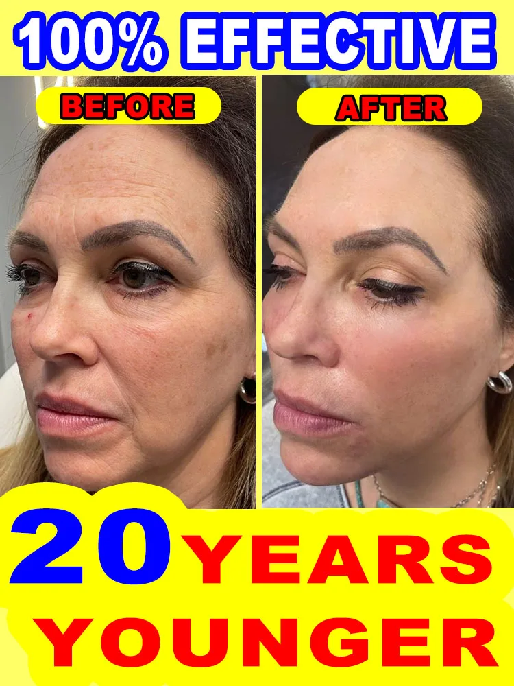 

20 years younger
