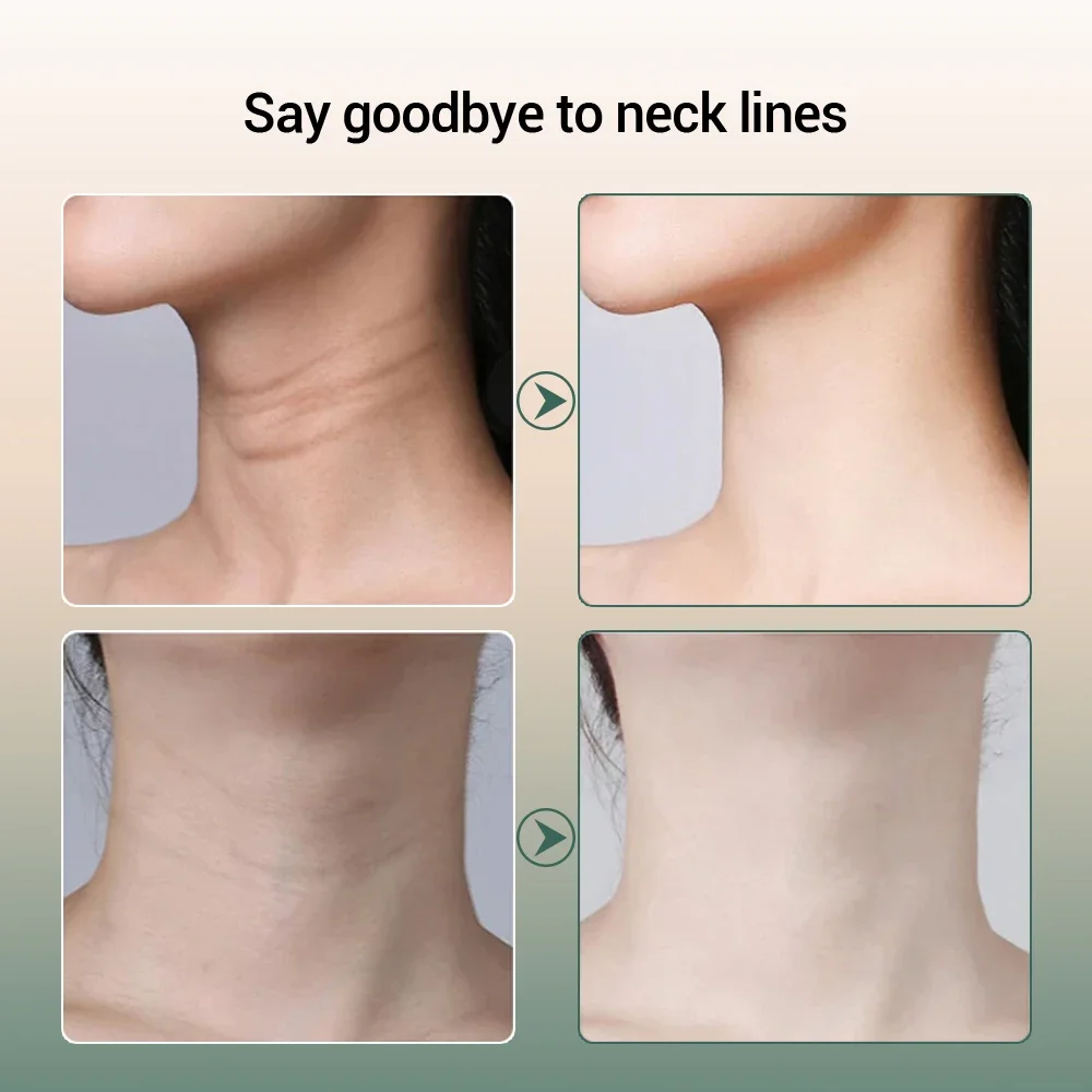 Neck Beauty Device 3-Color Face Lifting Massager Light Firming and Rejuvenating Skin Anti Wrinkle Skin Tightening