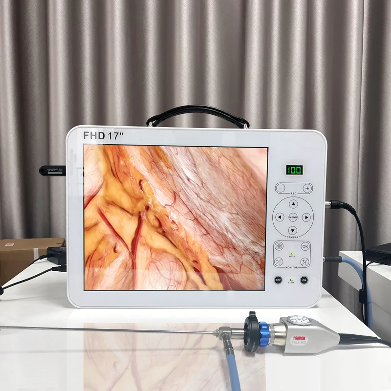 17 Inch Full HD Medical  Camera System for ENT Gynecology Portable Hysteroscope