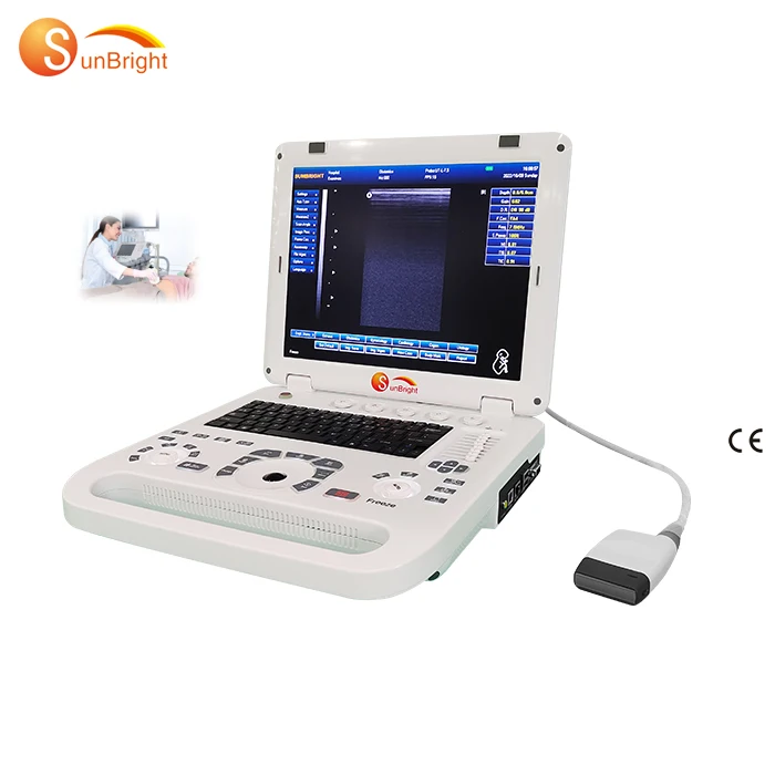 Medical Portable 3D Obstetric Digital OB/GYN Ultrasound machine