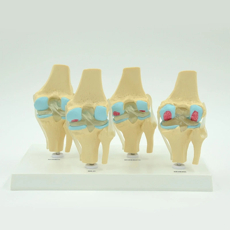 Flexible Human Knee Joint Anatomy Model Comparison of Knee Joint Model Scientific Life Size for