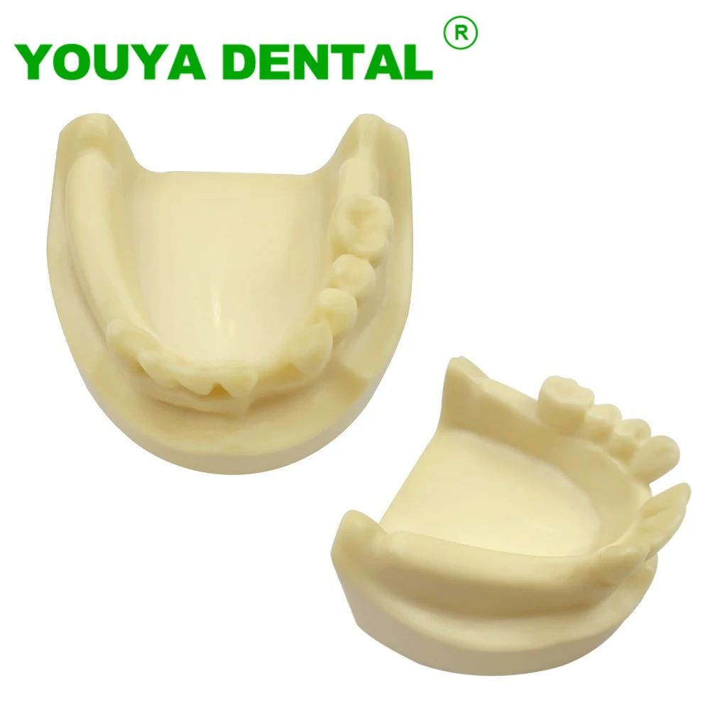 

Dental Implant Practice Model Lower Jaw Model With Missing Teeth For Dentist Student Studying Teaching Models Dentistry Products