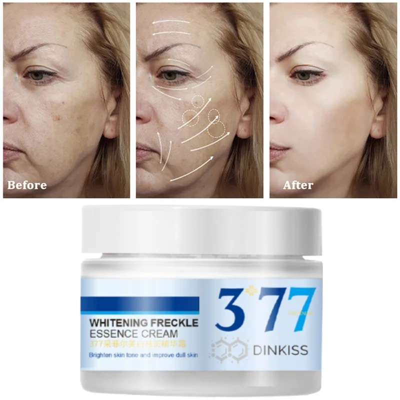 Whitening Freckle Cream Remove Dark Spots Pigmentation Senile Spots Sunburn Melasma Moisturizing Anti-Aging Face Care 50G