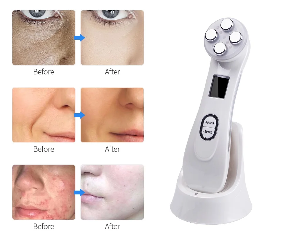 EMS Mesotherapy Electroporation RF Radio Frequency LED Photon Skin Care Neck Face Lifting Tighten Wrinkle Removal Beauty Machine