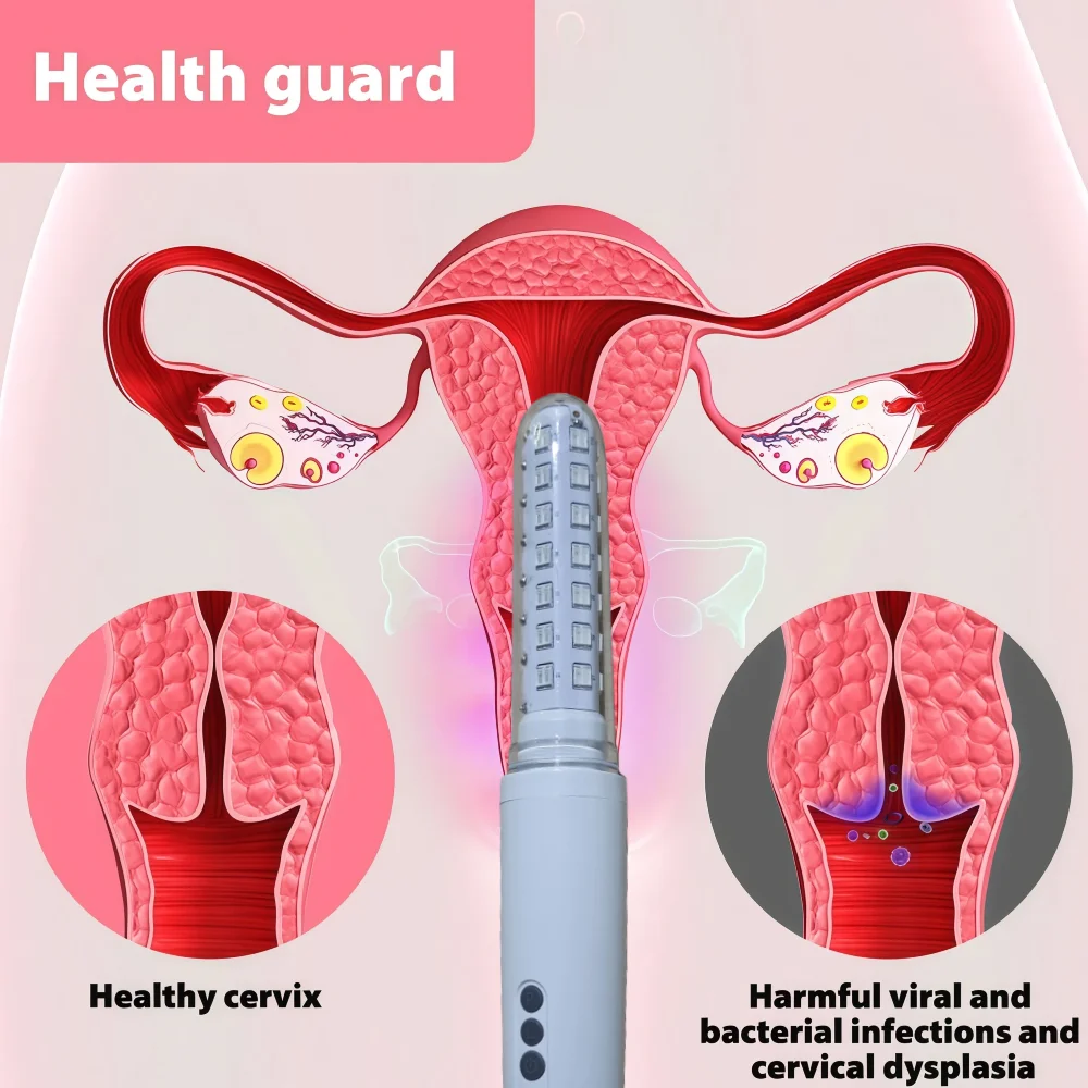 

Medical Cold Laser Vaginal Device, Professional Gynecological Equipment for Women's Tightening, Vaginitis and Health Care