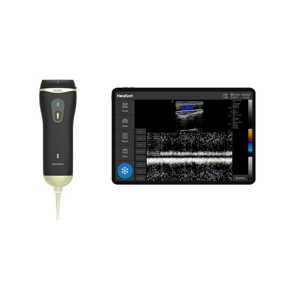 High end Medical Healthcare Pocket Ultrasound Scanner Rehabilitation Applicable In Hospital/emergency/outdoor