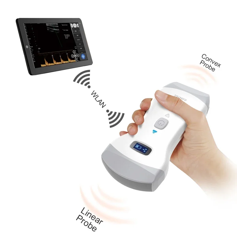 CONTEC อัลตราซาวนด์โพรบสี doppler เครื่องสแกนอัลตราซาวนด์ cms1600b