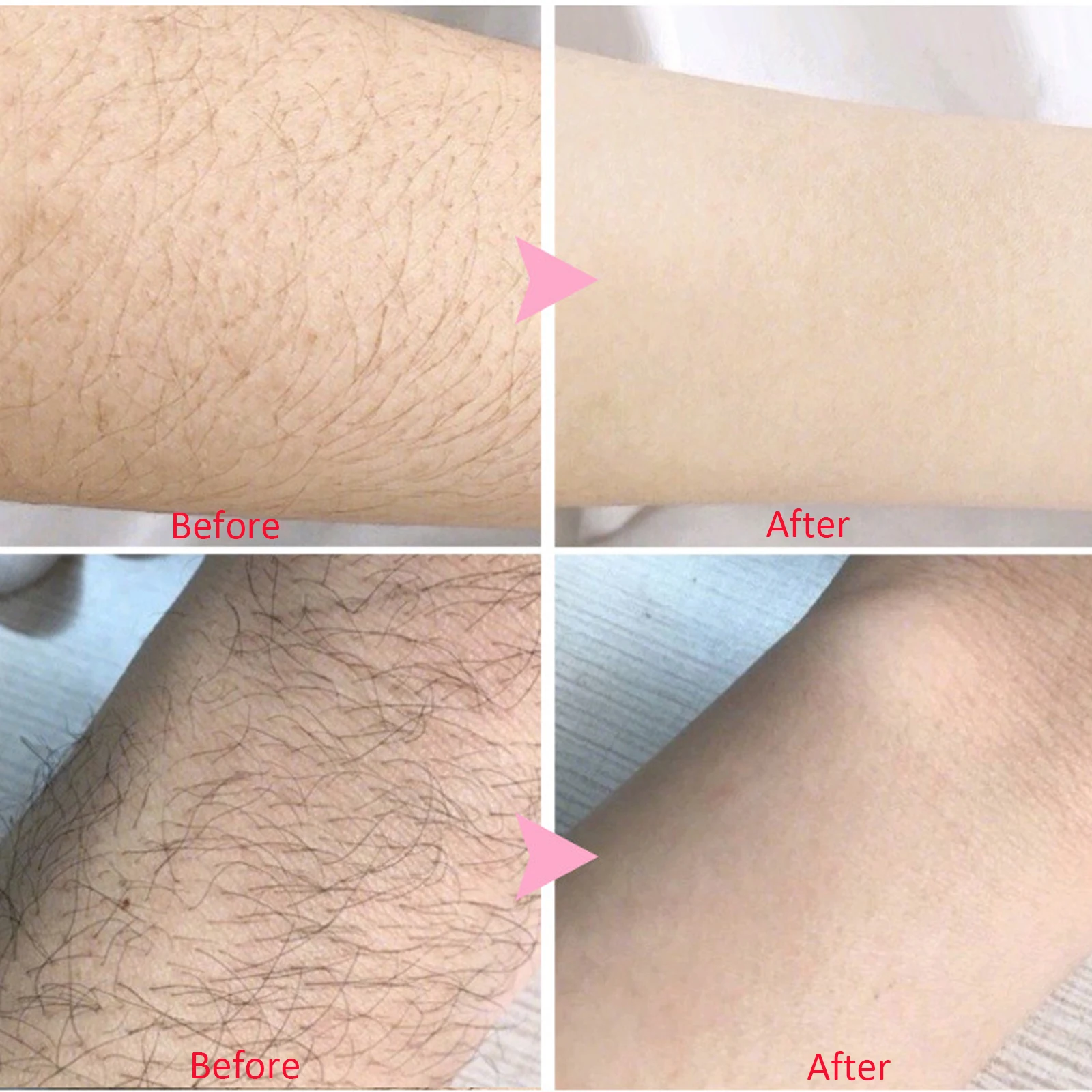 رذاذ إزالة الشعر السريع غير المؤلم مثبط نمو الشعر الذراع الإبط الساق مزيل الشعر الدائم للرجال النساء إصلاح الرعاية