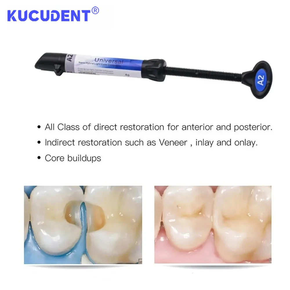 Dental Light Cure Resin Adhesive Kit Composite Bonding Shade A2 A3 Acid Etching Gel Universal Restoration Materials for Clinics