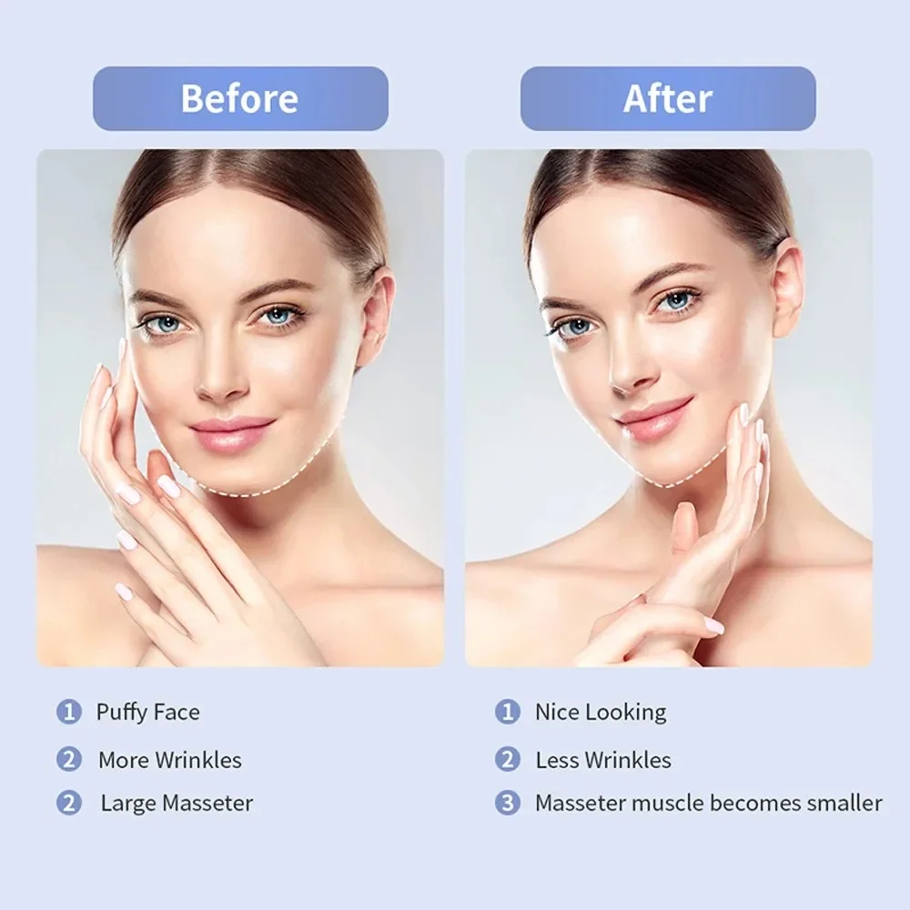 Electric V Face Lift Device Red/Blue Light Therapy Microcurrent Skin Tightening Double Chin Remover Face Slimming Care Massager