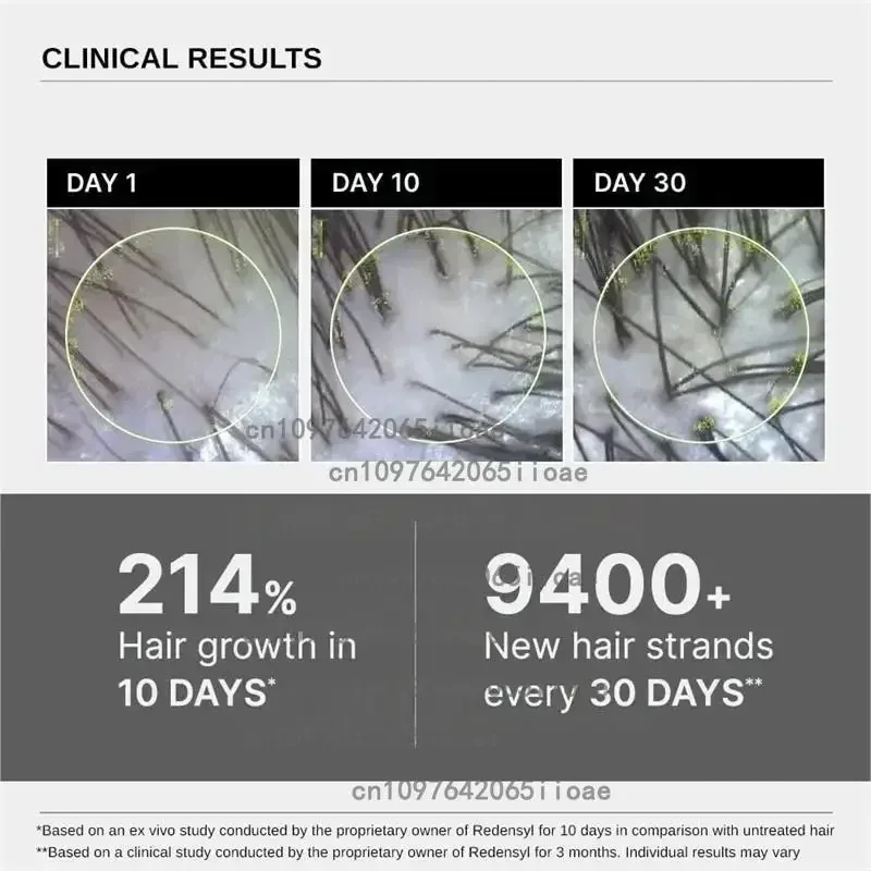 30Pflaster Haarwachstum Biotin Plus Pflaster für Frauen, Biotin Plus Polygonum Multiflorum