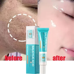 Salicylic Acid Pore Shrinking Cream Quick Remove Blackehead Smooth Skin Tighten Face Elimination Large Pores Korean Care Product