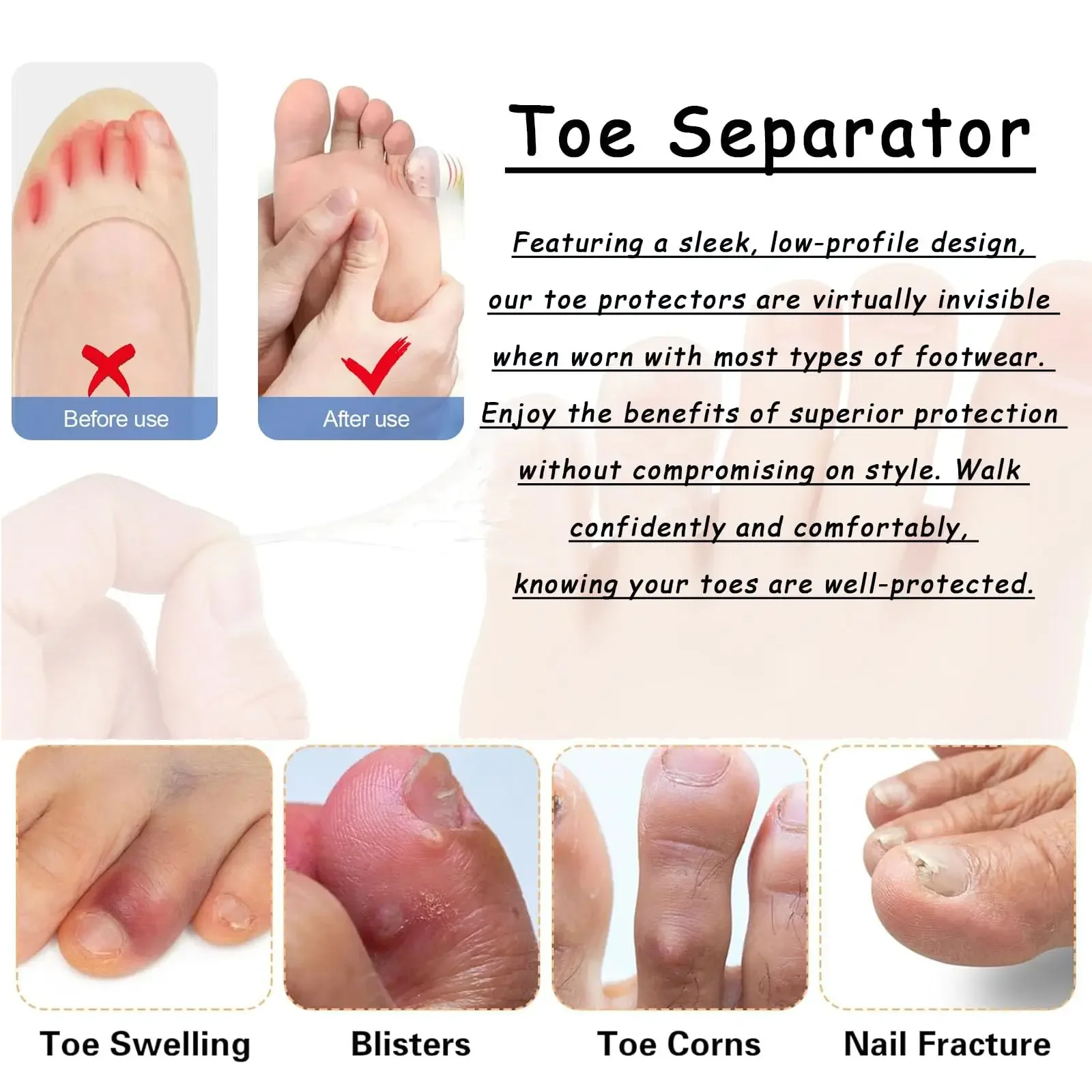 60/40/20pcs Toe Protectors Silicone Gel Caps Unisex Toe Cover for Corns Calluses Blisters Pain Relief Soft Toe Sleeves Cushions