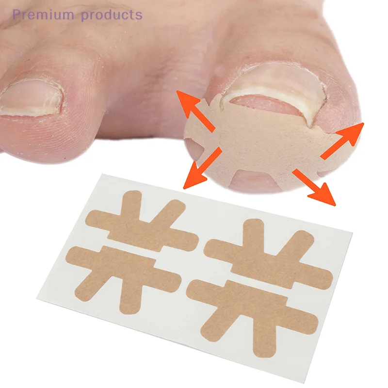 Zhengjia Tie Toenail Fungus Patch Sticky Nail Repair Patch Nail Ingrown Correction Sticker Toenail Care Paronychia Nail Patch