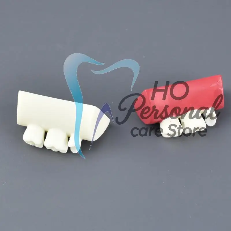 

Dental Inlay Exercise Model Block Filling Practice Typodont Resin for Dentistry Teaching Training and Student Study
