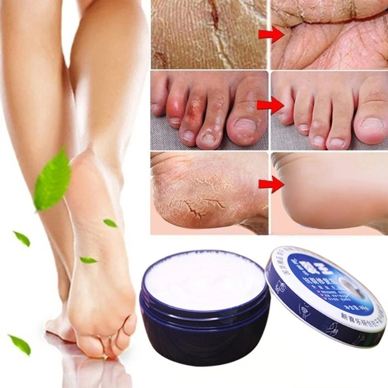 Anti-cracking Moisturizing Hand and Foot Cream Repair Heel Cracks Autumn and Winter Improve Rough Skin 88g