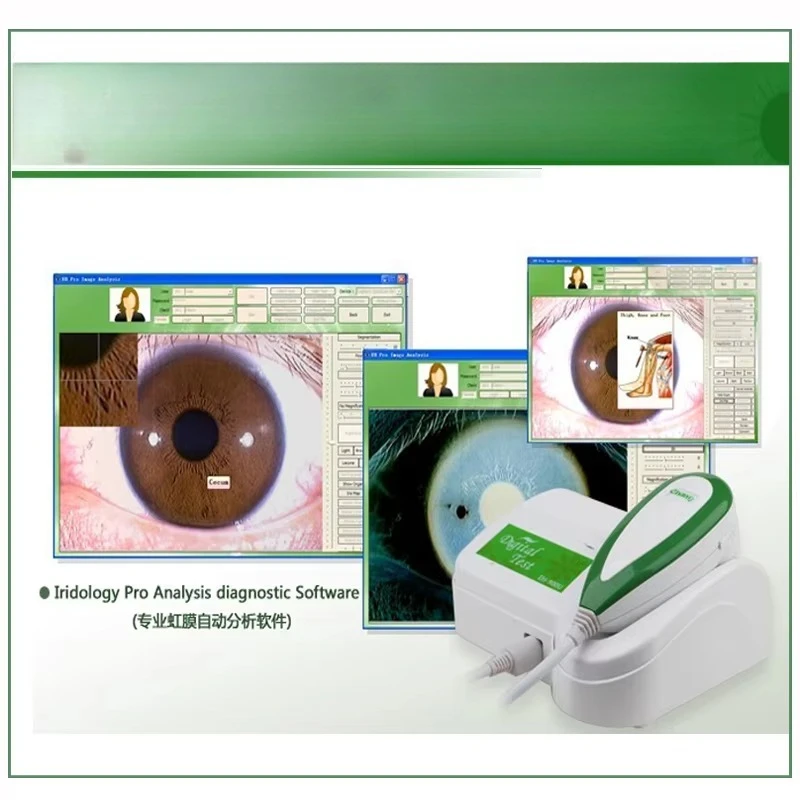 English 5MP Eye Iriscope – Iris        with Professional Iridology Body Analysis Software