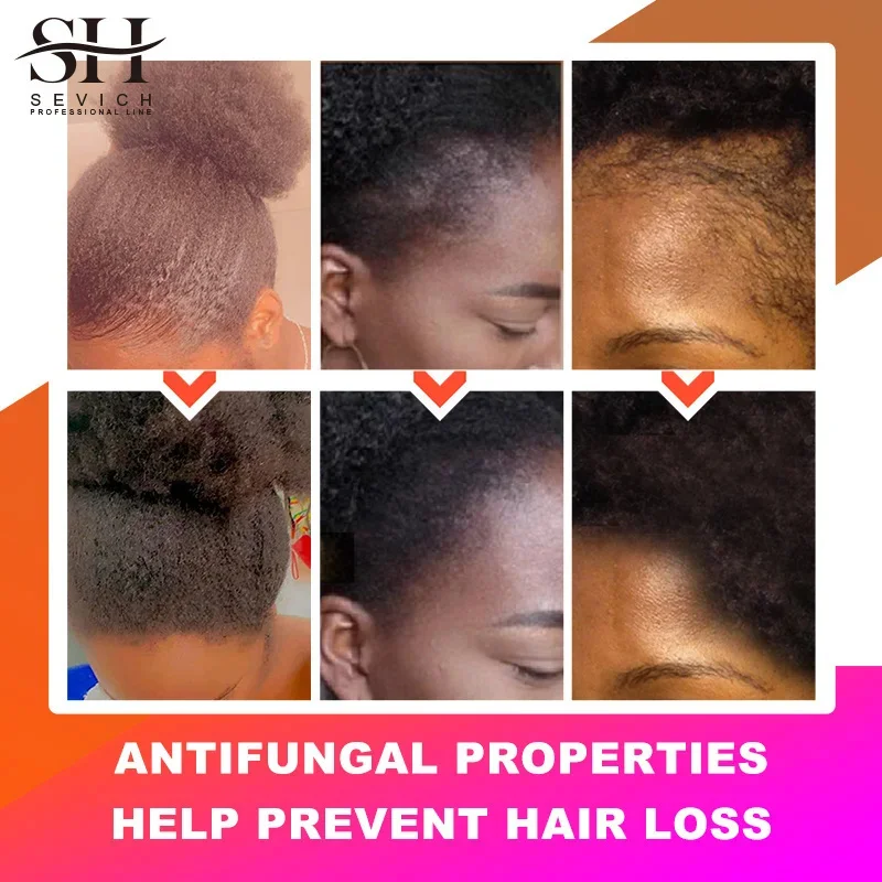 Chebe Fast Hair Growth Product African Crazy Traction Alopecia Hair Oil Anti Hair Break Hair Strengthen Hair Loss Treatment Care