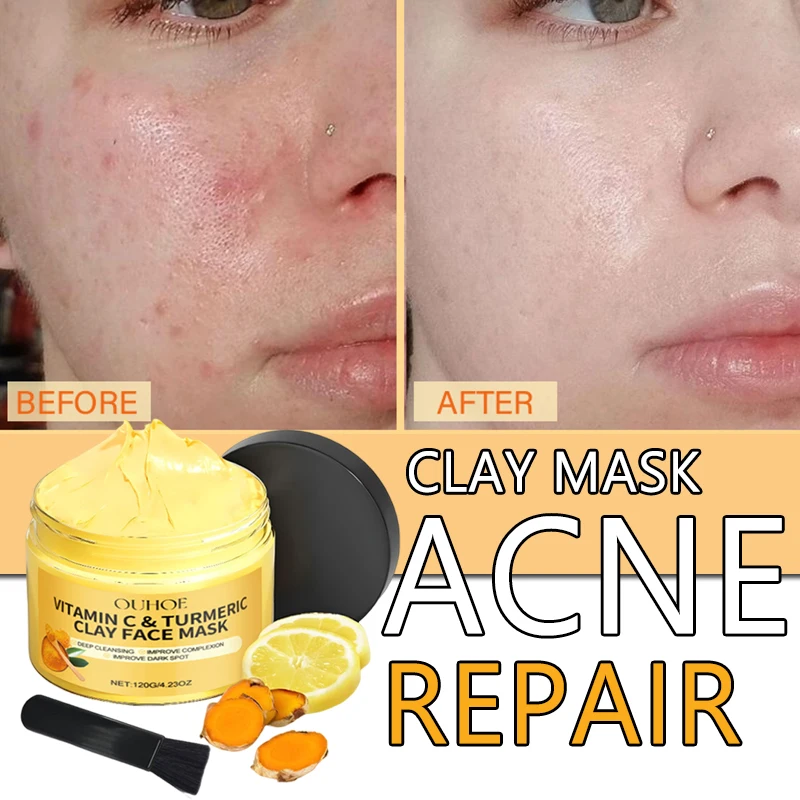 

Маска для лица с куркумой и витамином С для глубокой очистки с глиной каолины, куркумой от прыщей, темных пятен, отшелушивающего контроля жирности, очищающего поры