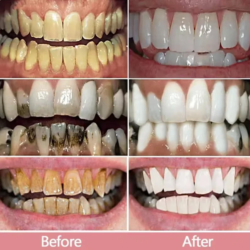 100g Teeth Whitening Toothpaste Fast Remove Smoke Coffee Tea Stains Cleaning Oral Hygiene Plaque Fresh Breath Bleaching Dental