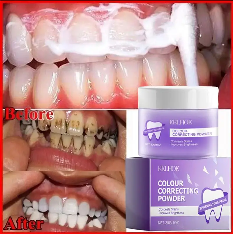 

5 Days Teeth Whitening Powder Remove Plaque Stains Dental Calculus Oral Hygiene Cleaning Fresh Bad Breath Tooth Care Products