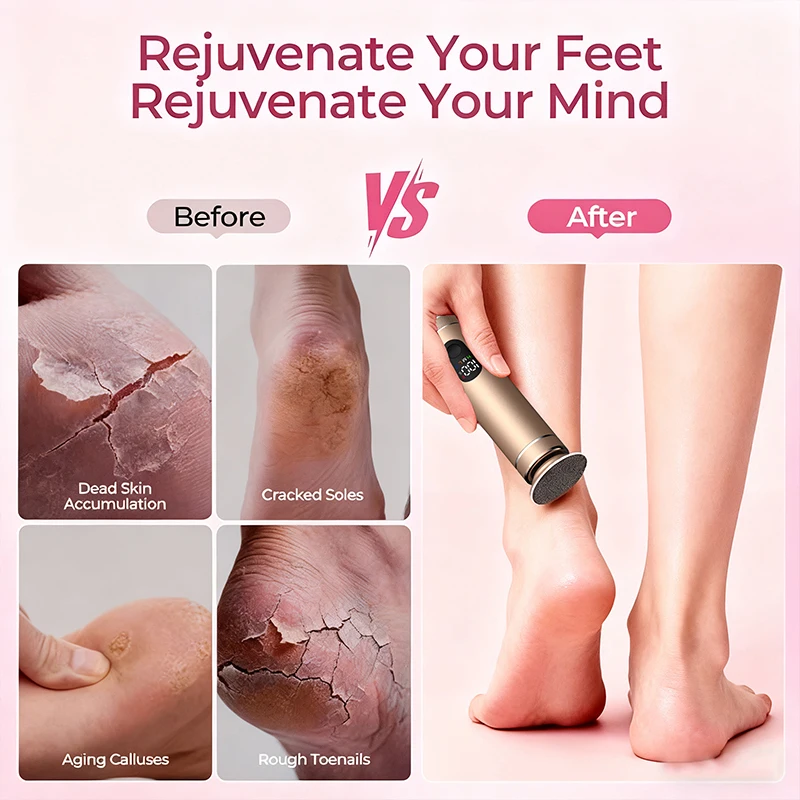 أدوات العناية الكهربائية للقدم واليد 2 في 1 من سبائك الألومنيوم، مزيل مسامير القدم الكهربائية، مطحنة طعام كهربائية مع صندوق هدايا #4