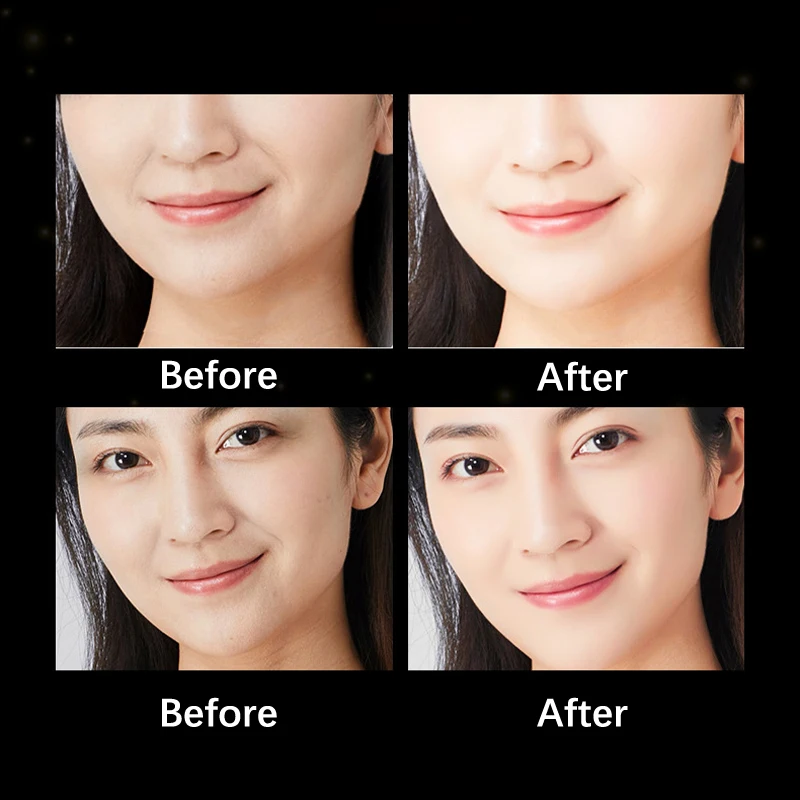 Autocollant anti-déformable et anti-rides pour le visage, masque pour les yeux, front et cou, patchs anti-âge, 5 pièces