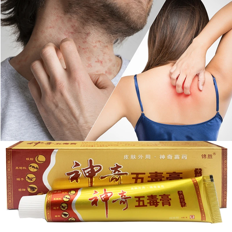 1pcs 15g chinesische Medizin Anti-Juckreiz-Creme YG-2135