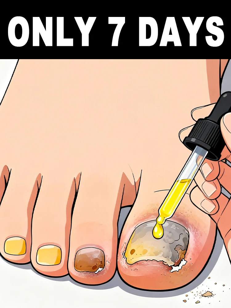 

Continue using it for a few weeks,ᵃⁿᵈ ᵗʰᵉ ᵉᵐᵖᵗʸ ⁿᵃⁱˡ ʷⁱˡˡ ᵍʳᵃᵈᵘᵃˡˡʸ ᵍʳᵒʷ ⁱⁿᵗᵒ ᵃ ⁿᵉʷ ⁿᵃ