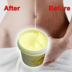 50g Genuine Thailand Skin Body Cream Remove Stretch Marks Treatment Postpartum Repair Whitening CREAM Scar Removal Free shipping