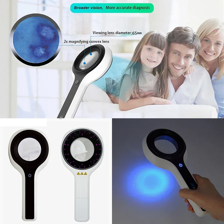 2026 320nm Filtered Ultraviolet Lamp Detect Different Fungal Infection Site Certain Metabolic Skin Disease Solve Problem