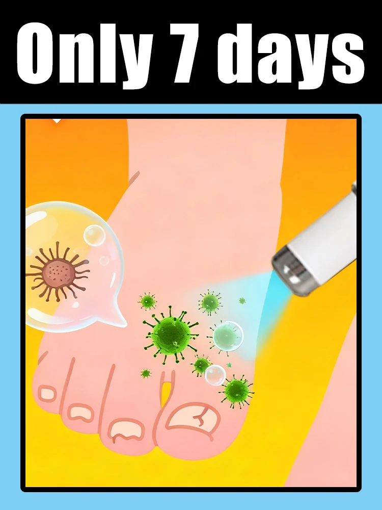 caneta laser Um dispositivo obrigatório de terapia a laser com luz azul para famílias, as unhas tornam translúcidas e sem fungos.