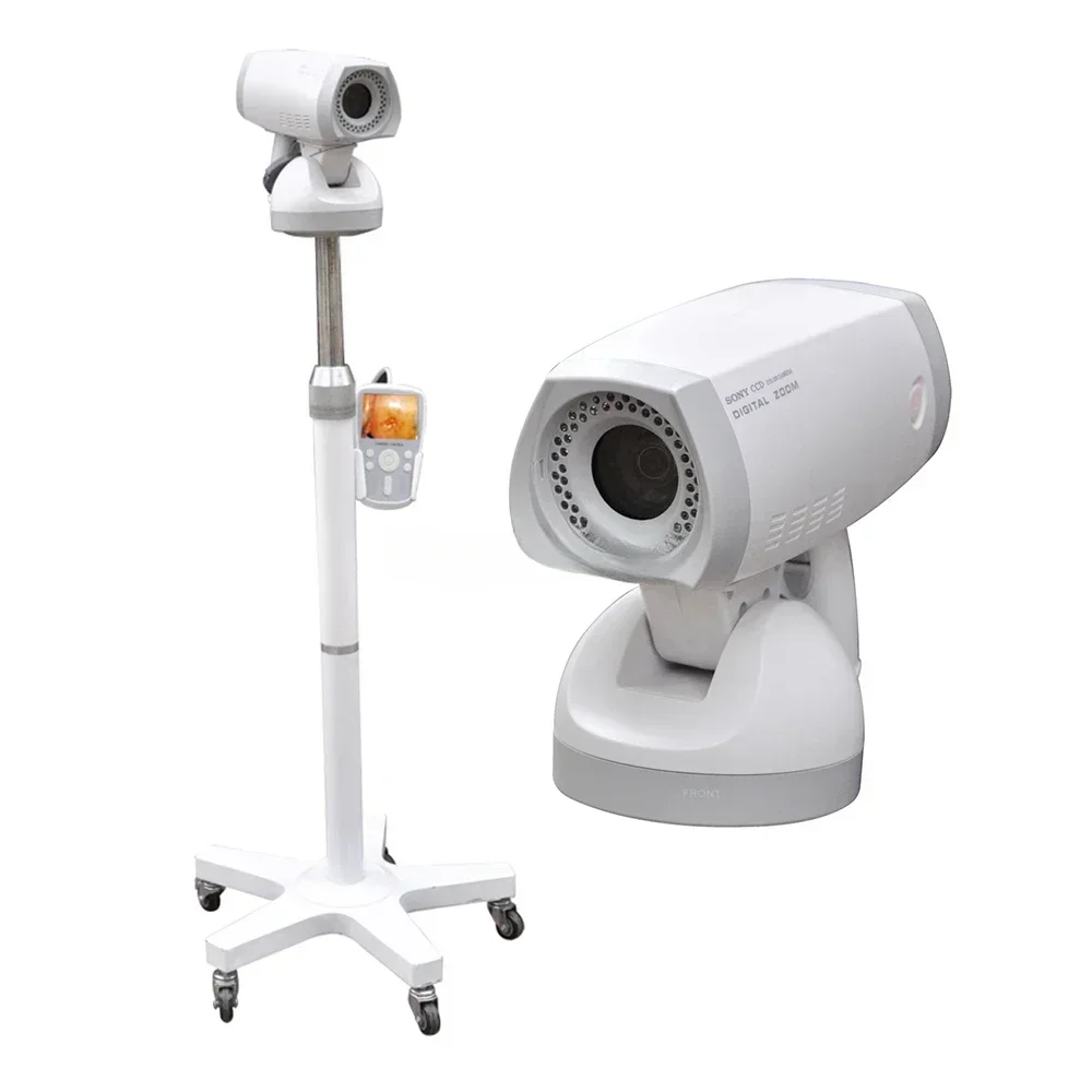 LH9800A Colposcopy Gynecology Full Hd Digital Electronic Video For Gynecology/