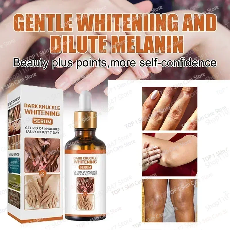 Knuckles whitening Dark Skin ascella schiarente aree intime ascellare cura della pelle del corpo parti intime crema sbiancante bellezza salute