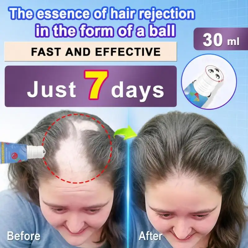 Hair Growth Roller Ball Serum Scalp Nourishing Essence Liquid Gentle Hair Root Conditioning Formula Support Healthy‑Looking Hair For Men Women Daily Hair Care Use