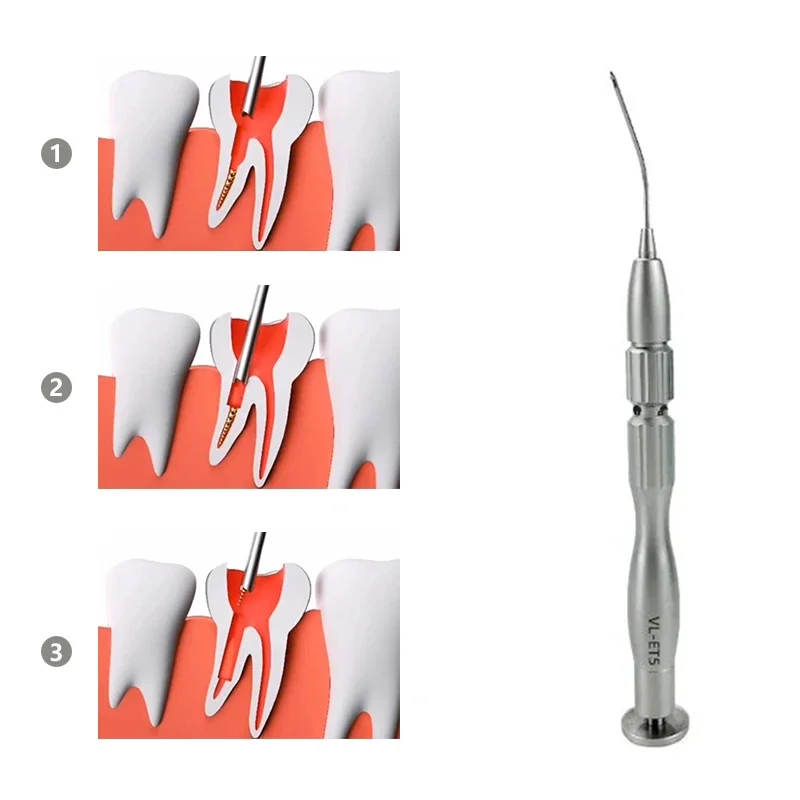 DentalS Root Canal File Extractor RemovalS System Kit Broken Endo Files Tool