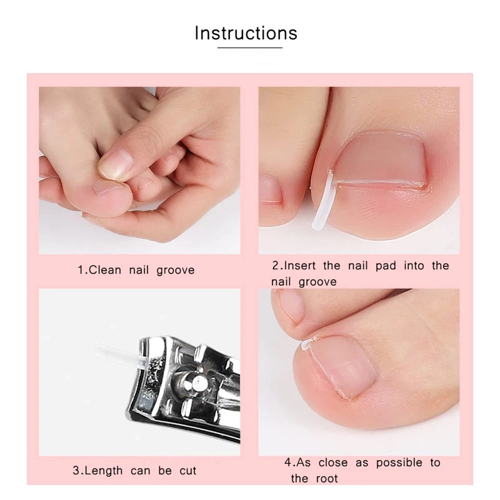 10 Stks/set Voetverzorging Tool Behandeling Bunion Paronychia Ingegroeide Nail Pad Groove Ortho Correctie Pads Teennagel Corrector