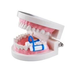 20pcs/50pcs Dental Cotton Roll Clip Ortho Plastic Blue Isolator Tool Disposable Cotton Holder Dentist Clinic Lab Supplies