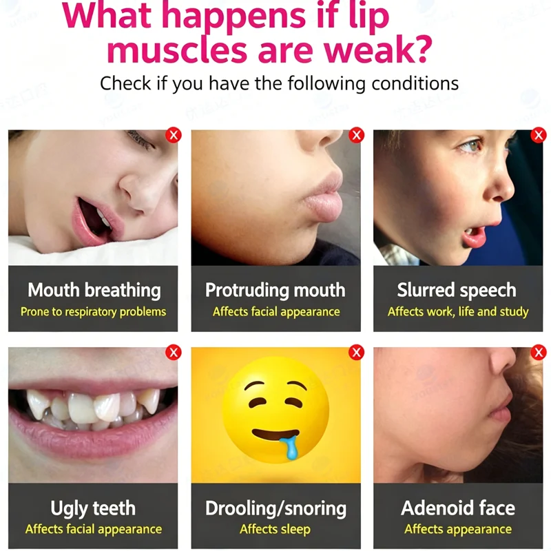 Dental Australian MRC Lip Trainer Kids Mouth Breathing Corrector Oral Myofunctional Trainer Adenoid Facies Lip Muscle Training
