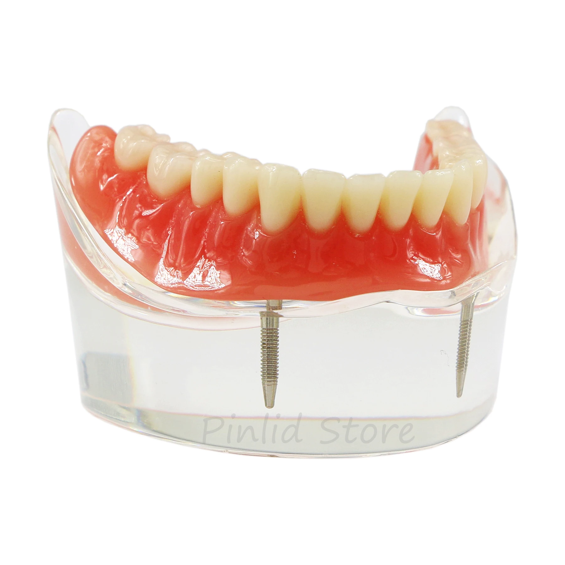 Dental Research Models Physician Student Practice Teaching Denture Overlay Demonstration Model 6002